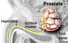 La próstata continúa su crecimiento hasta que se alcanza la edad adulta y mantiene su...