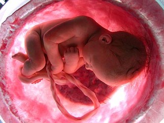 El aborto es uno de los miasmas de nuestra sociedad enferma. La insensibilidad ante la muerte...