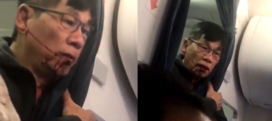 El pasajero que fue arrastrado en Chicago para bajarlo de un vuelo sobrevendido de United Airlines...