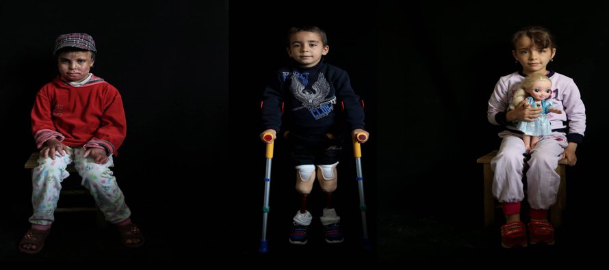 Fadil Amir, de 11 años de edad, fue gravemente herido en el brazo izquierdo y en la mano en...