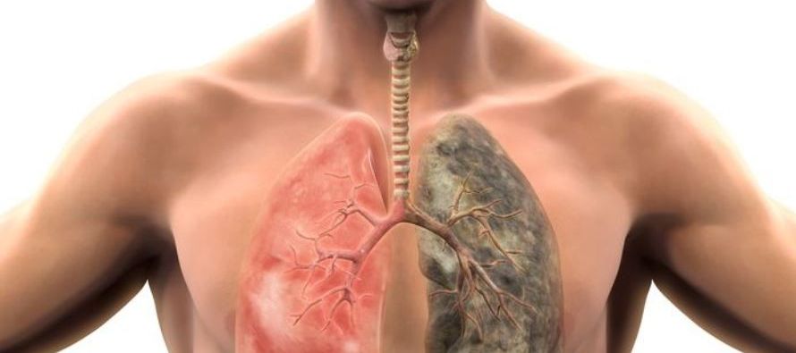El cáncer de pulmón es la primera causa de muerte en México, pero el estigma,...