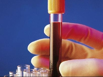 La anemia es un problema endémico de gran magnitud cuyas consecuencias pueden ser...
