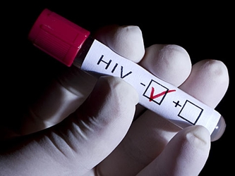 De acuerdo a las cifras, de 24 mil a 25 mil australianos son portadores del VIH, mientras unos 10...