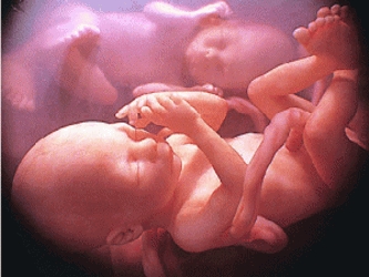 Con el anteproyecto de ley del Gobierno sobre el aborto, se ha acentuado más, si cabe, un...