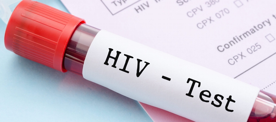 "Hay más de 15 millones de personas que todavía viven con el VIH. El 25 % de...