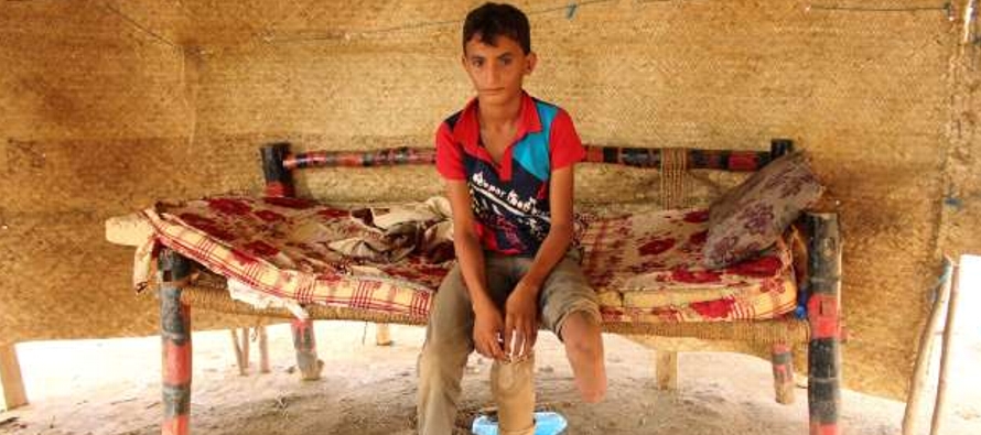 Abdullah, de 12 años, perdió la pierna izquierda en un ataque aéreo hace tres...