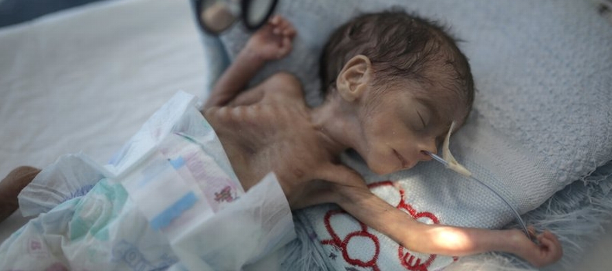 La grave predicción estaban en un nuevo reporte de UNICEF, “Yemen cinco años...