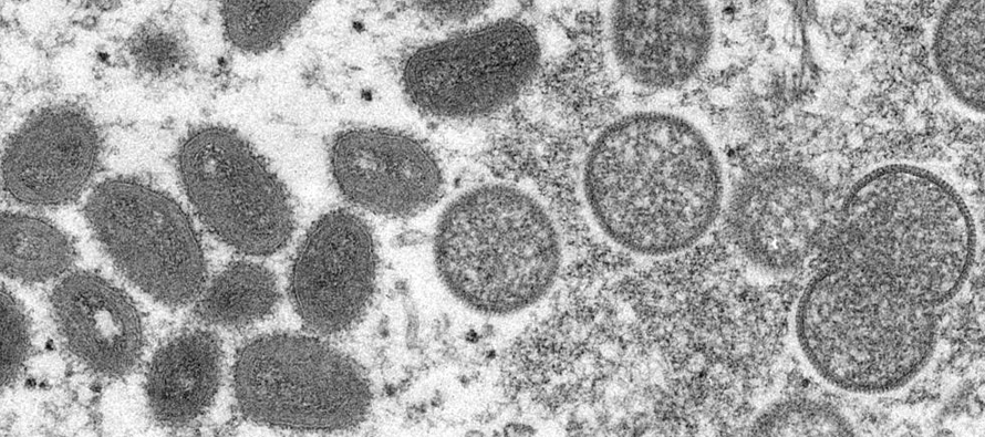 La OMS ha registrado por ahora más de 90 casos de viruela símica en una docena de...