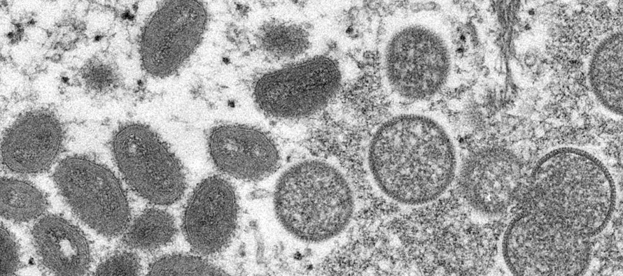 Hasta la fecha, la OMS dijo que 23 países que no habían tenido viruela símica...