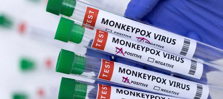 Muchos casos de viruela del mono durante el brote reciente en Europa y Estados Unidos se detectaron...